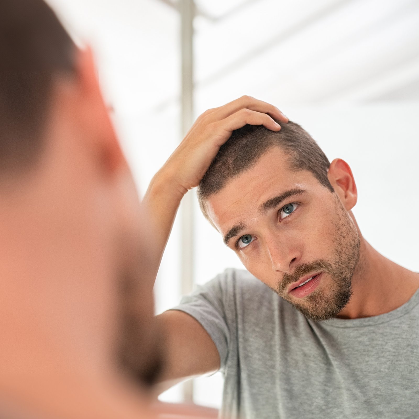 Hair Transplantation